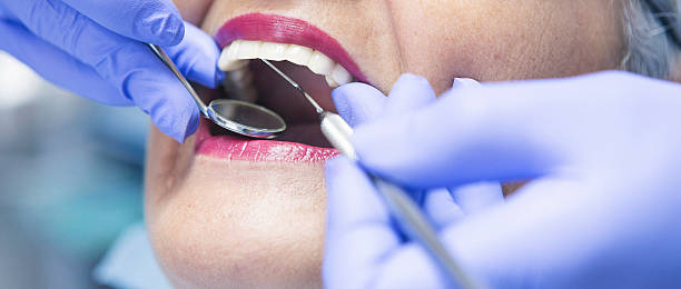 Best Emergency Root Canal Treatment in Mcminnville, OR